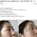 [공지] 병원카페마케팅, 맘카페 왜 효과 없을까요?