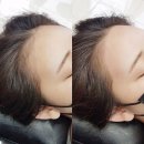 투투헤어라인 | 구미 진평동 왁싱 / 브라질리언 이마 헤어라인 전문 [뷰티쏘유]