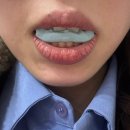 예반 | 대전 둔산동 안면비대칭 교정 예반한의원 내돈내산 후기