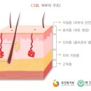 피부노화 이미지