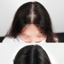 리게인프로젝트 강남본점 이미지