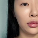 선메디텍 | 이중턱관리 고민 끝! 아트메디텍 브이라인밴드 강추