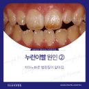 미니쉬치과병원 이미지