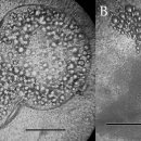 자연산 붕어 아가미의 Dermocystidium 이미지