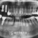 청주으뜸치과의원 이미지