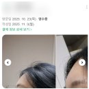 청담미의원 네이버블로그