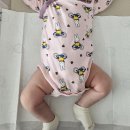 포항성모병원 | 포항 아기 고관절탈구 검사 후기 (ft.포항 성모병원 정형외과/역아/양수과소증/다리주름 비대칭)