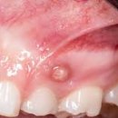 자주고름 이미지