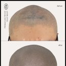 탈모왕 본점 이미지