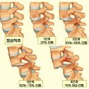 허리 스트레칭으로 통증 잡기 ( 의자에서, 서서, 누워서 자세별 스트레칭) 이미지