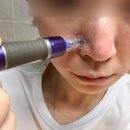 파란약국 | 약국에도 입점 되어있는 모공 디바이스 &#34;식스킨&#34; 내돈내산 사용후기