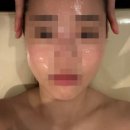 오목한의원 | [천안] 가비온 다이어트 V랩 관리 비포 애프터 후기 천안에스테틱 추천
