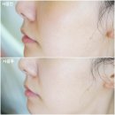 H1526 이미지