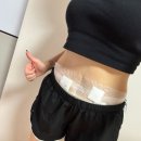 푸디스트(주) 수원중앙병원점 | 수원지방분해주사 뱃살빼기 달라진 옷핏 리얼 내돈내산 후기