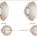아이디안경 네이버블로그