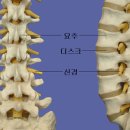 요추질환 ㅡ요통 이미지