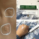 수진하나약국 | 점뺀후재생크림 관리방법 주의사항 약국재생크림추천