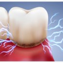 가야치과병원 이미지