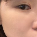 의정부피부관리<탈모락바이피부수작>관리받고온 솔직후기, 여기는 진짜 관리의 끝판왕!
