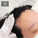 김헤어라인 | 진천역 대구두피문신 입소문 난 tutu 튜튜 가르마 헤어라인 후기