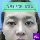 비씨아이성형외과의원