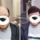 김호증모가발춘천체인점 이미지