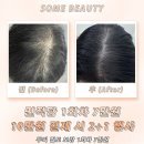 청천중앙 | 두피문신 후기 + 전후 변화 | 석남·청라·청천 접근성 좋은 샵