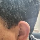 시그니아독일보청기대구북구센터 이미지