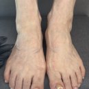 김돈이(익산영등2호점) | [영등] "샌들 신기 전 필수!" 숨기고 싶은 발톱 고민, 이제 '오발완' 하세요 | 아이슈네일 100% 결과...
