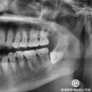 연세청천세브란스치과의원 이미지