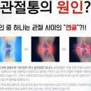 황산 콘드로이친, 글루코사민 효능 연골재생에 효과 이미지