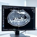 탑연합의원 | 으아, 이가 아파서 잠 못 자는 건 정말 국룰이죠?