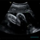 분당-38 | 임신후기 38주 정기검진.(분당제일여성병원)