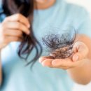 원형 탈모증 부위에 ‘이것’ 슥슥 발랐더니...탈모 완화하는 자연 치료법은? 이미지