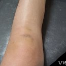 모세휠체어 이미지