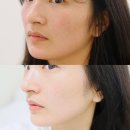 드웰 | 마산피부관리 웨이브온 리프팅 후기 드웰에스테틱에서 턱선·볼살 라인 정리됨