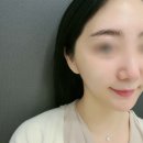 오라클피부과의원(화곡점) | 밴스의원 화곡 리쥬란힐러 후기/스킨부스터로 피부관리 고민 끝