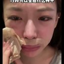 15만 위안(3300만원) 쓰고 얼굴 성형한 중국 여성 이미지