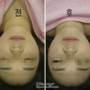 [안산 고잔동 마사지] 신비안 에스테틱 :: 조형근막관리 받고 온 후기! 1회만으로도 서프라이즈 :)