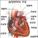 심장판막질환(펌) 이미지