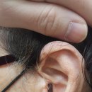 시원한보청기 이미지