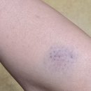 장기농약사 이미지