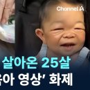 아기 몸으로 살아온 25살…여동생의 ‘육아 영상’ 화제 / 채널A / 뉴스A 이미지