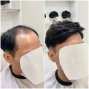 마스터가발김호증모영등포
