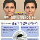 몽드로쉐 이미지