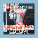 바로나음신경외과의원 | 등 통증으로 일자목(목디스크)진단 받은 후기 (ft 개봉동 서울탑신경외과의원)
