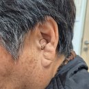 대구장애인보장구신고센타 | 대구보청기 지원금 2026년 최신 정보 정리