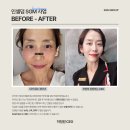 미소해 인셀덤 이미지