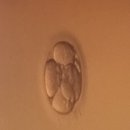 배양 | 대구마리아 고령 극난저(AMH 0.1) 난소PRP 배양PRP 효과 및 후기, 난자채취 갯수가 늘었다!