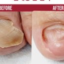 네일 수 이미지